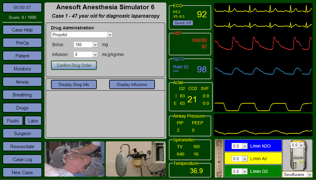 Anesthesia Simulator